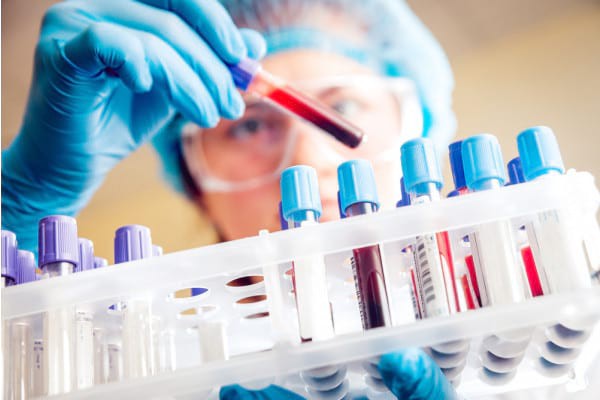 Analize pentru diagnosticarea infertilității la femei