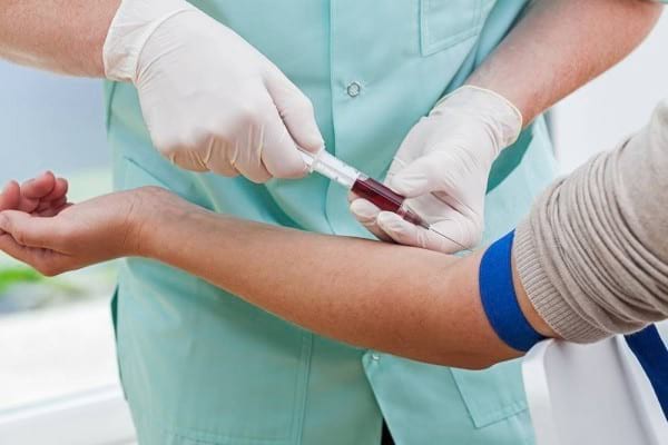 Dislipidemia: semne, diagnostic, tratament. Ce substanțe active ajută
