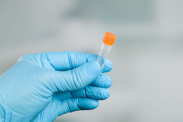 Studiu: Disruptorii endocrini afectează calitatea lichidului seminal