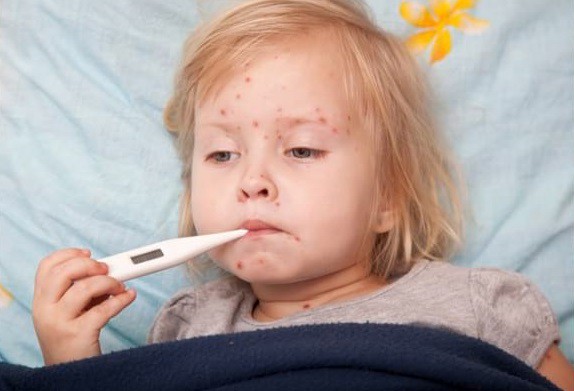 De la ce a pornit, de fapt, epidemia de rujeolă din România?