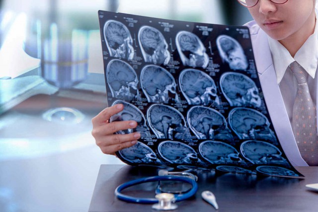 Ziua Internațională de Conștientizare a Tumorii Cerebrale: Noi terapii inovatoare