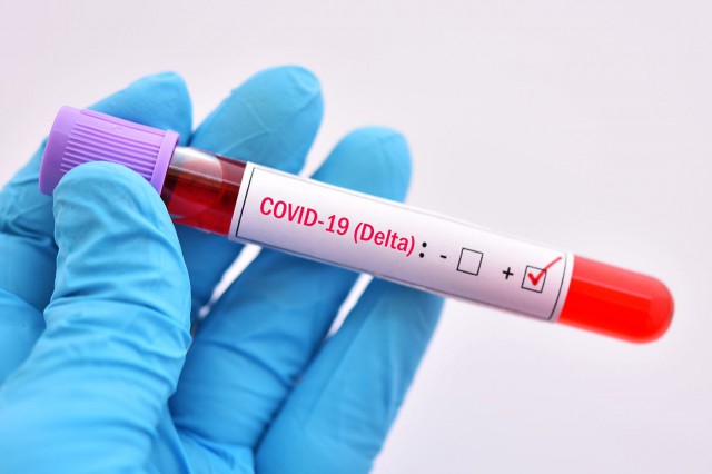 Coronavirus: Varianta Delta a devenit predominantă în Irlanda