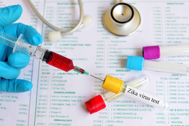Studiu: Virusul Zika inhibă proliferarea cancerului de prostată?