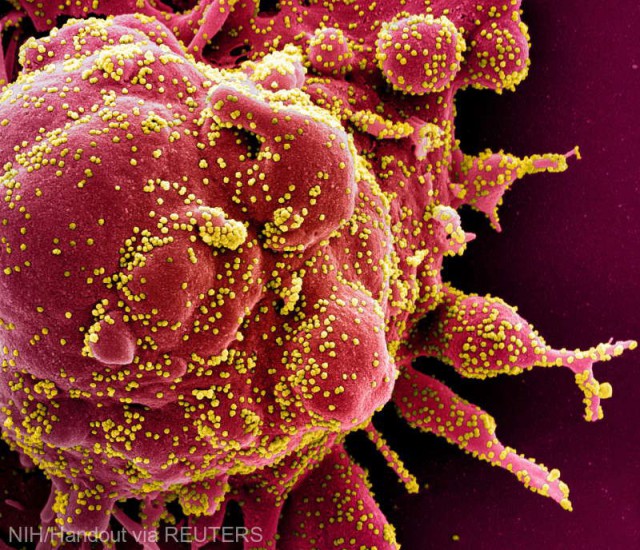 Oamenii de ştiinţă au utilizat editarea genetică Crispr pentru blocarea replicării coronavirusului în celule