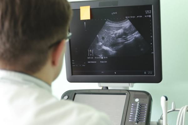 Hemangiomul hepatic: cauze, simptome și tratament