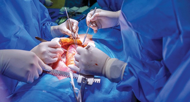 ANT: 76 de transplanturi de la donatori aflaţi în moarte cerebrală, efectuate de la începutul anului