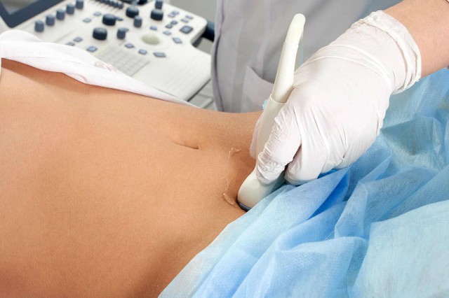 Diagnosticarea timpurie a cancerului ovarian nu salvează mai multe vieți