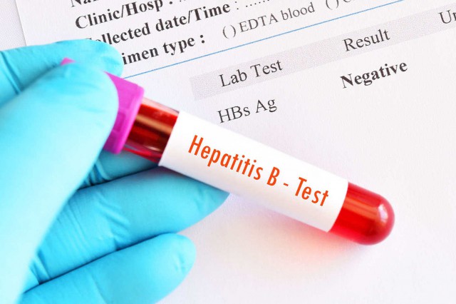 Tratamentul hepatitei B: speranțe pentru un tip de imunoterapie