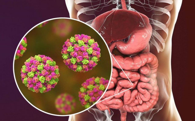Epidemie de Norovirus la Râşnov. Peste 140 de persoane s-au prezentat la medic
