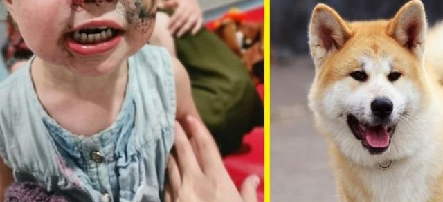 Un COPIL de 3 ani a fost MUȘCAT de FAȚĂ, de un CÂINE, când făcea BAIE în MARE!