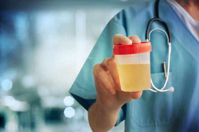 Studiu: Cancerul de vezică urinară ar putea fi detectat mai ușor