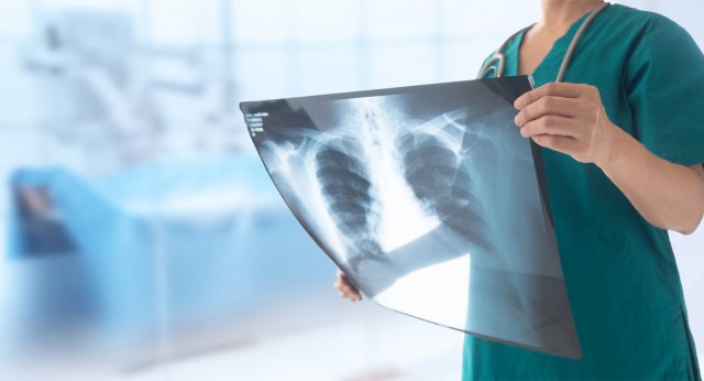 Pneumonia ambulantă: simptome, cauze și tratament