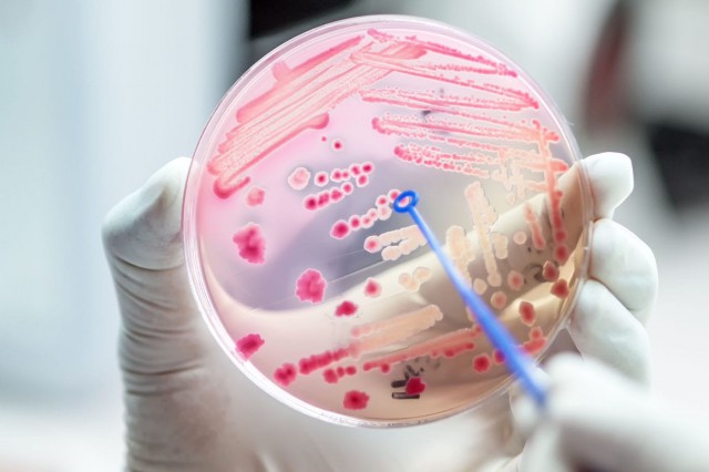 Studiu: Rezistența la antibiotice, contracarată cu virusuri bacteriofage?