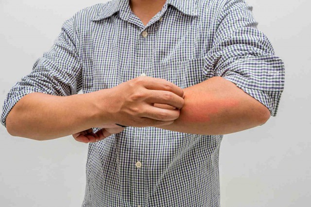 Alergii de toamnă și problemele de piele asociate