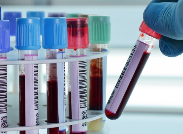 Marea Britanie demarează studiul clinic al unui test de sânge care poate detecta 50 de tipuri de cancer
