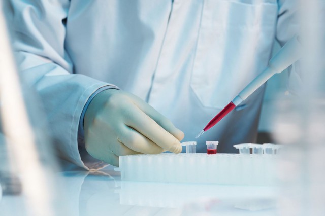 Celulele stem universale ar putea trata mai bine bolile cardiovasculare