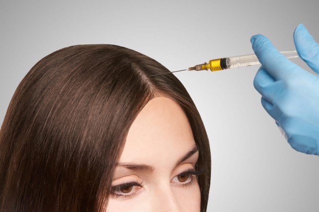 Terapia PRP poate fi eficientă împotriva căderii părului
