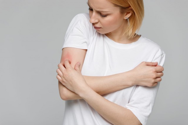 Dermatografismul sau urticaria dermatografică: simptome, cauze, tratament