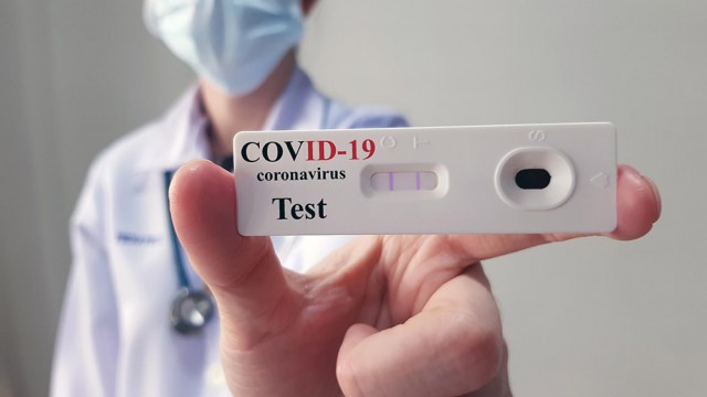 Ministerul Sănătăţii: Gradul de pozitivare pentru testele COVID este de 12.71%