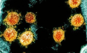 COVID-19: Legătura dintre tulpinile noi și HIV netratat