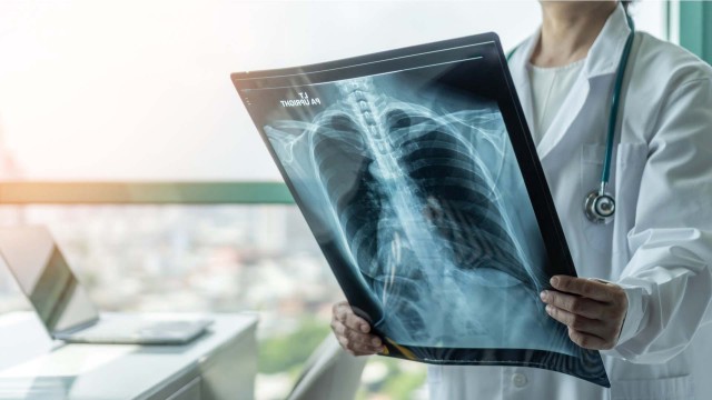 De ce apare cancerul pulmonar la nefumători?
