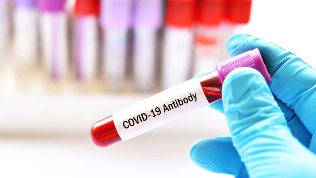 COVID-19: Standardizarea masurării nivelului de anticorpi