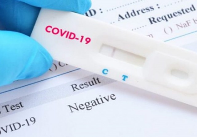 Rafila îi îndeamnă pe cei care îşi vizitează rudele vulnerabile să îşi facă un test Covid