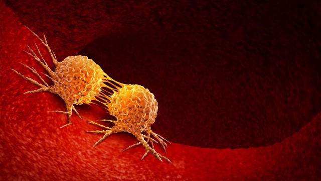 Studiu: Colesterolul mărit ar putea alimenta celulele canceroase