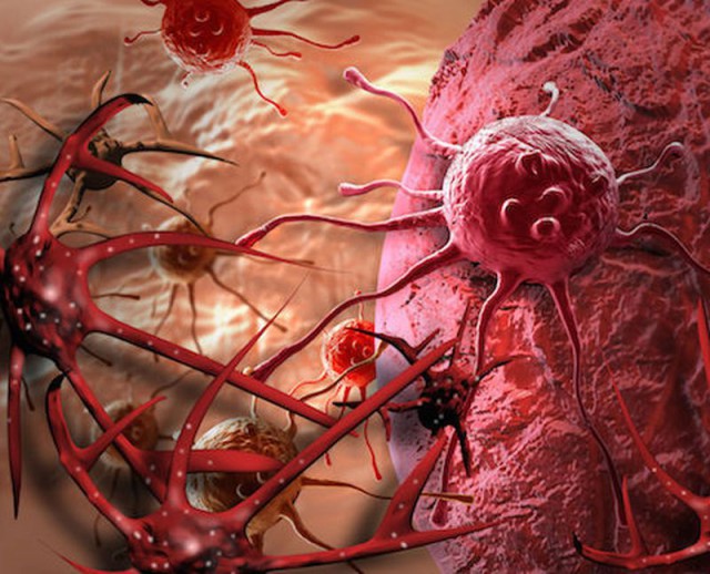 Studiu: 'Bacteriile din tumori ajută celulele canceroase în procesul de metastază'
