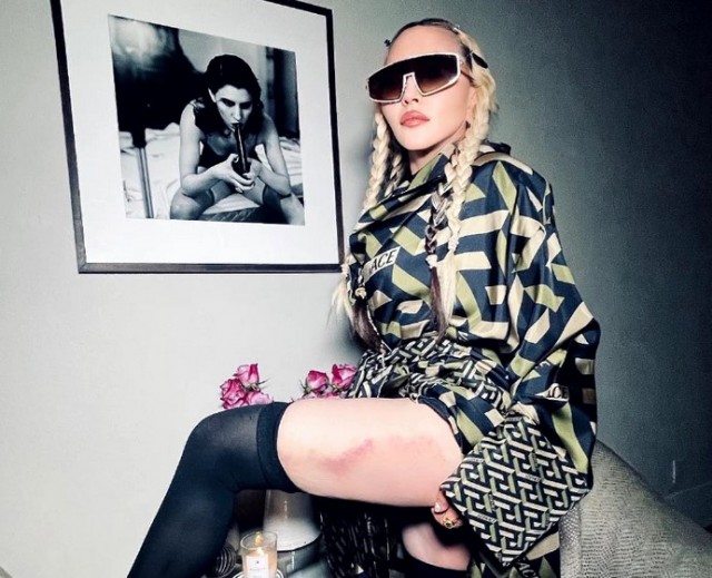 Madonna și-a șocat fanii! Diva de 63 de ani a postat poze cu o ditamai vânătaia