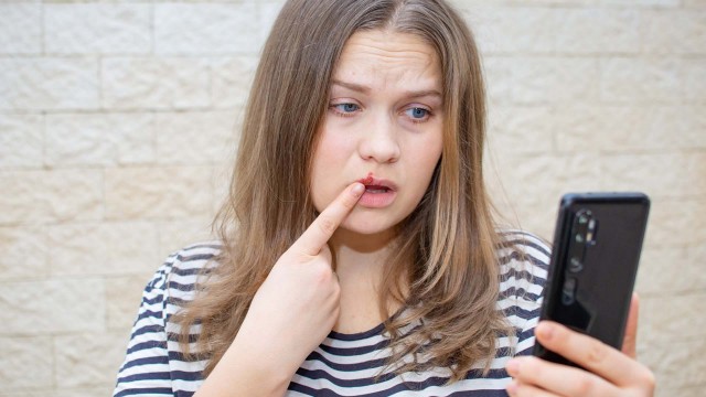 Ce legătură este între herpes și bolile neurodegenerative?