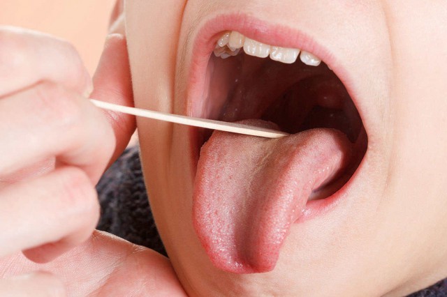 Microbiomul limbii și rolul în sănătate