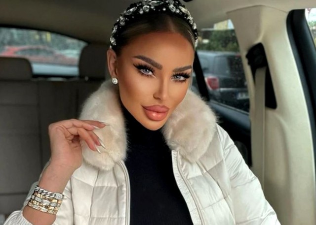 Bianca Drăgușanu își topește buzele la propriu! Video cu schimbarea radicală, din timpul intervenției