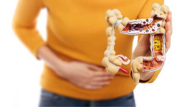 O combinaţie de medicamente reduce tumorile în cea mai frecventă formă de cancer intestinal