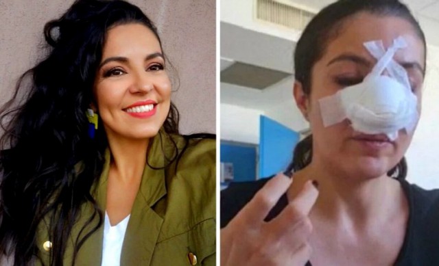 Cristina Joia, mărturii despre operațiile prin care a trecut, la un an de la atac
