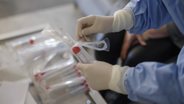 OMS anunţă o scădere importantă a numărului de cazuri noi de COVID-19 la nivel global