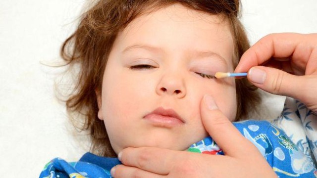 Copii ai refugiaților ucraineni, la spital cu simptome de conjunctivită, boală extrem de contagioasă