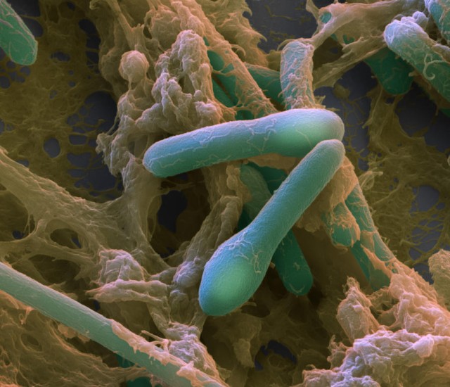 DSP a sesizat organele de cercetare penală în cazul apei de la Breaza contaminată cu bacteria clostridium perfringens