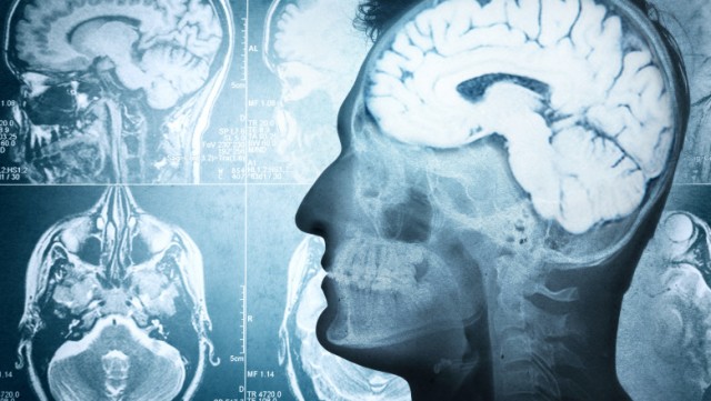 Efectele pe care experiențele stresante le au asupra creierului