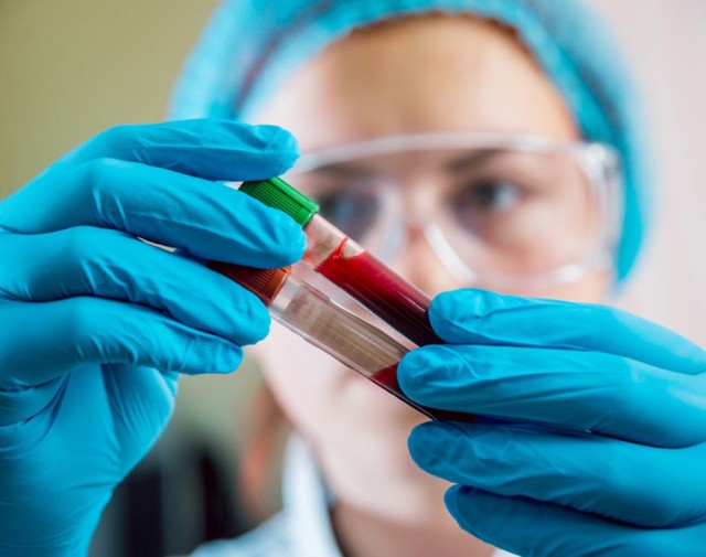 ALERTĂ: Hepatită de origine necunoscută la copii. E necesar transplant de ficat