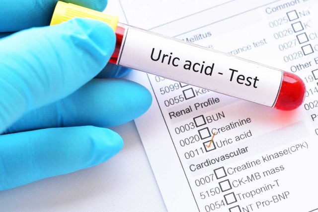 Studiu: Acidul uric joacă un rol important în sindromul metabolic
