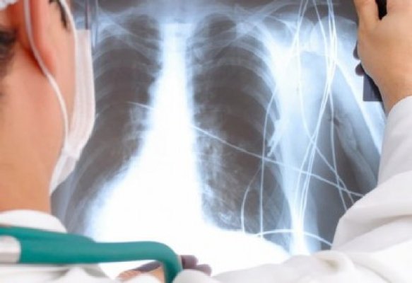 Incredibil ce au descoperit medicii în stomacul unui băiat, care avea dureri și stări de greață